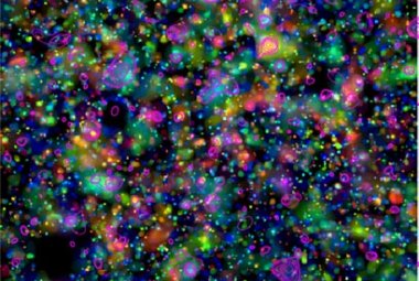 Zdjęcie przedstawia rozkład galaktyk obserwowany przez Kosmiczny Teleskop Hubble'a. Kolory odpowiadają odległościom galaktyk. Różowe kontury przedstawiają emisję rentgenowską zaobserwowaną przez satelitę XMM-Newton. Źródło: ESA